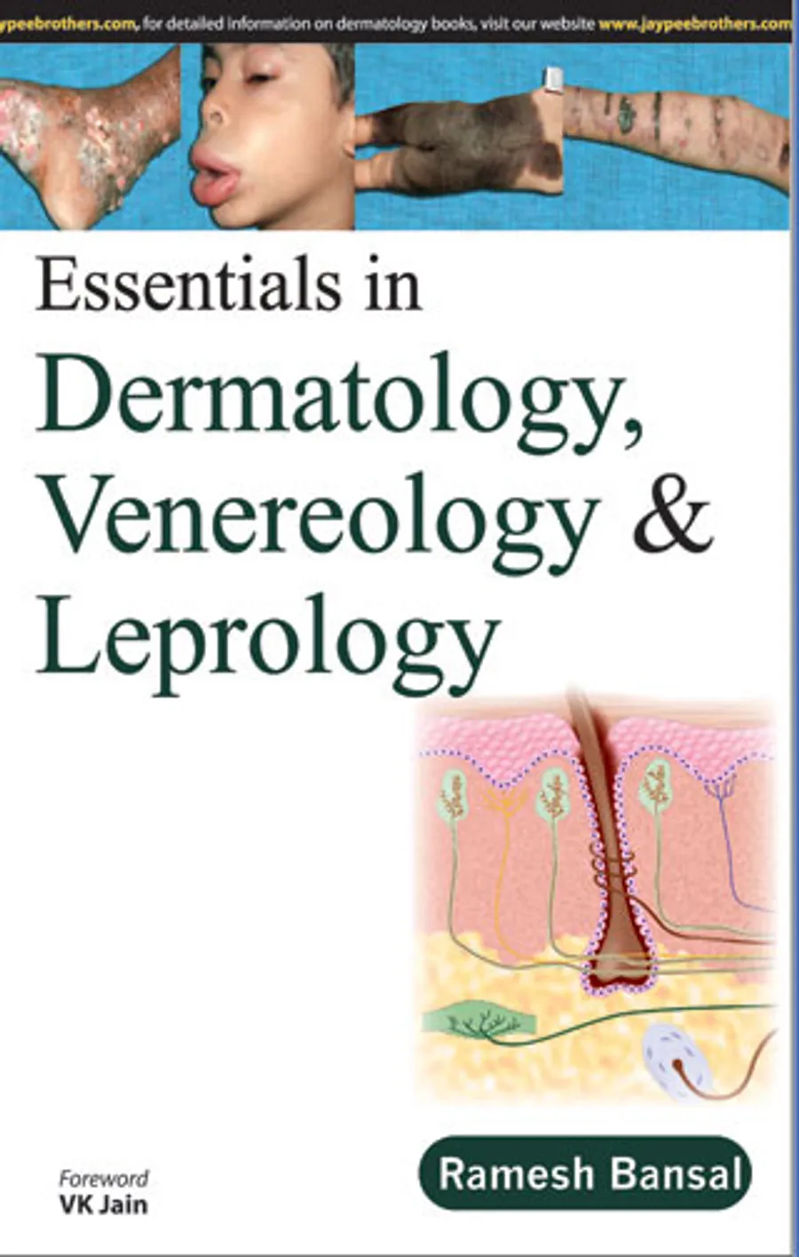 Essentials In Dermatology,Venereology & Leprology | Paperback