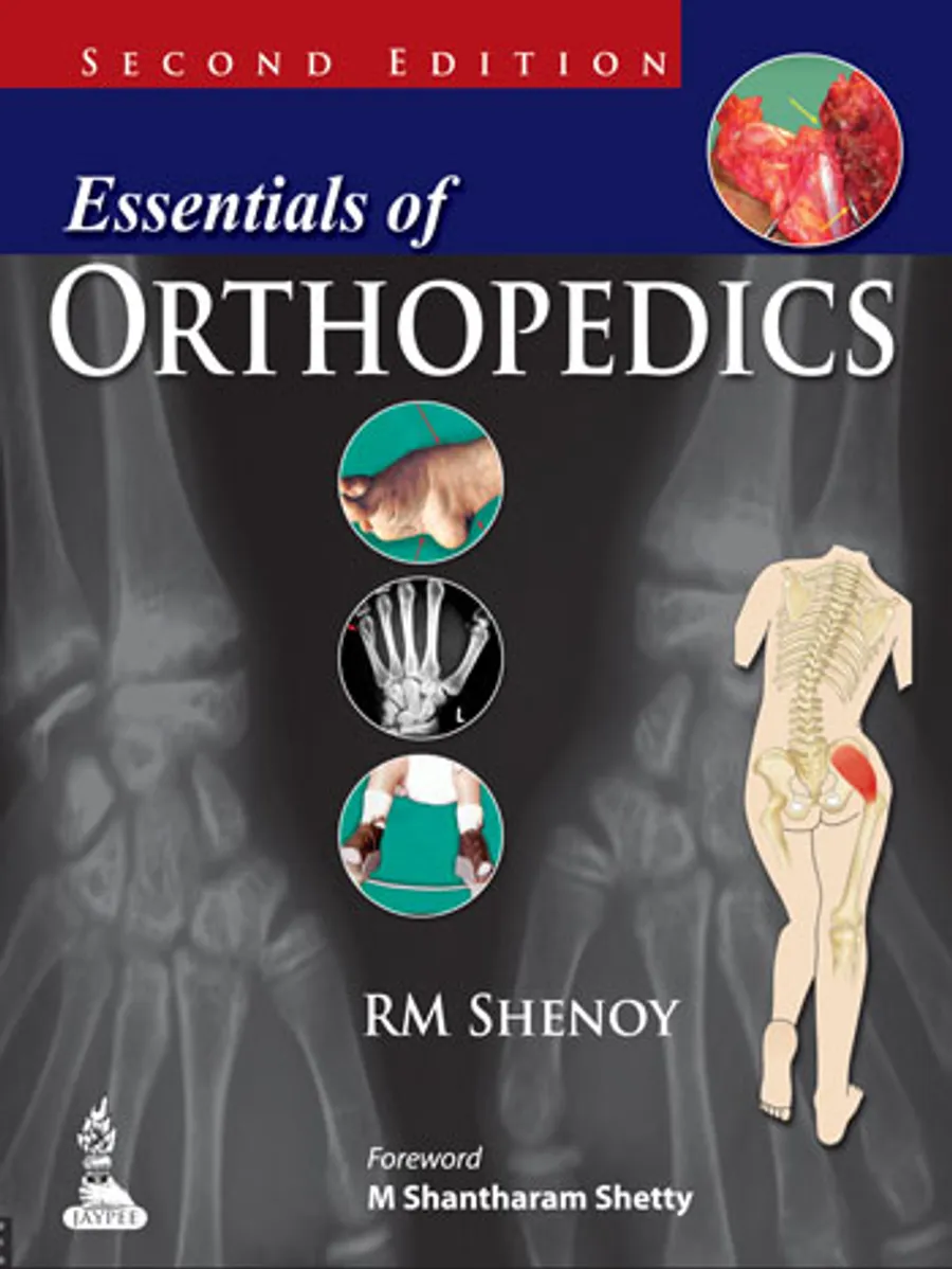 Essentials Of Orthopedics | Paperback