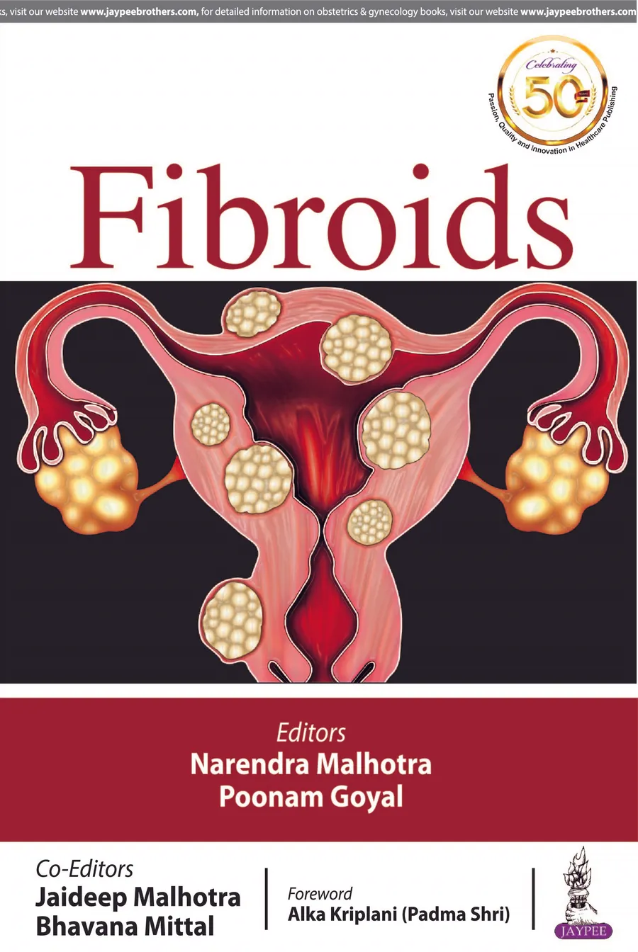 Fibroids | Paperback