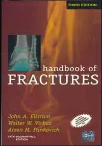 Handbook Of Fractures