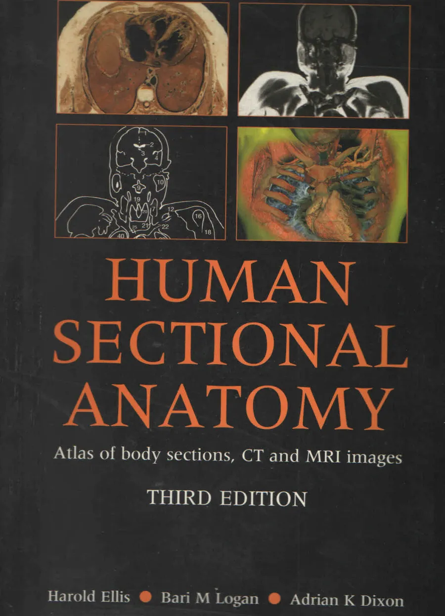(Old)Human Sectional Anatomy Atlas Of Body Sections, Ct And Mri Images | Paperback
