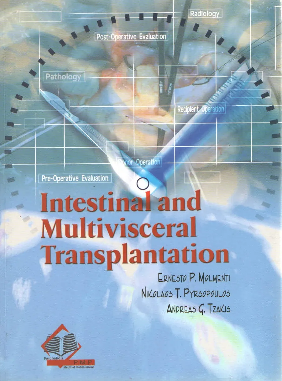 Intestinal And Multivisceral Transplantation | Paperback