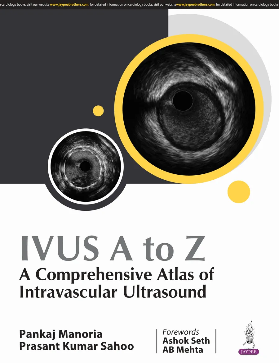 Ivus A To Z : A Comprehensive Atlas Of Intravascular Ultrasound | Paperback