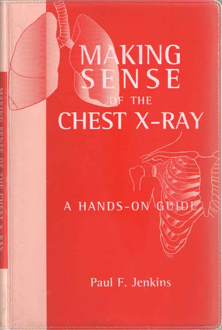 (Old)Making Sense Of The Chest X-Ray : A Hands-On Guide(Org) | Paperback
