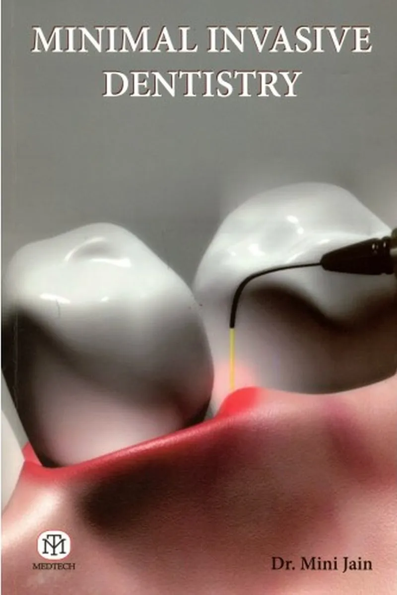 Minimal Invasive Dentistry | Paperback