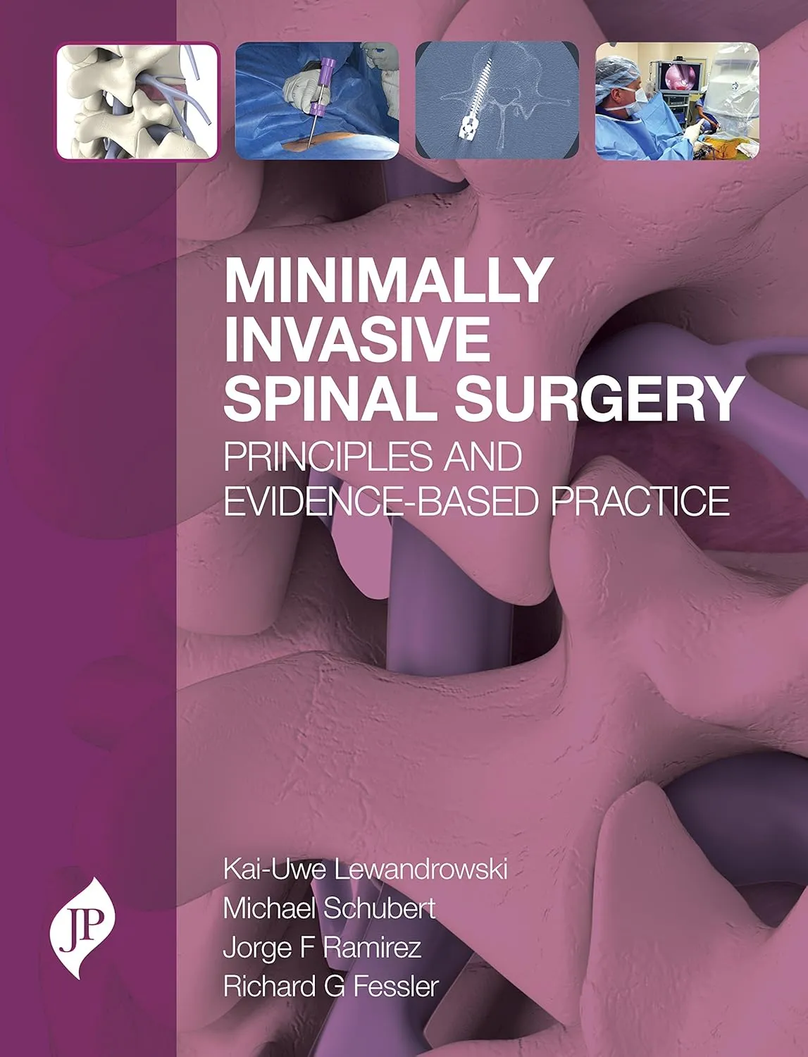 Minimally Invasive Spinal Surgery Principles And Evidence-Based Practice | Hardcover