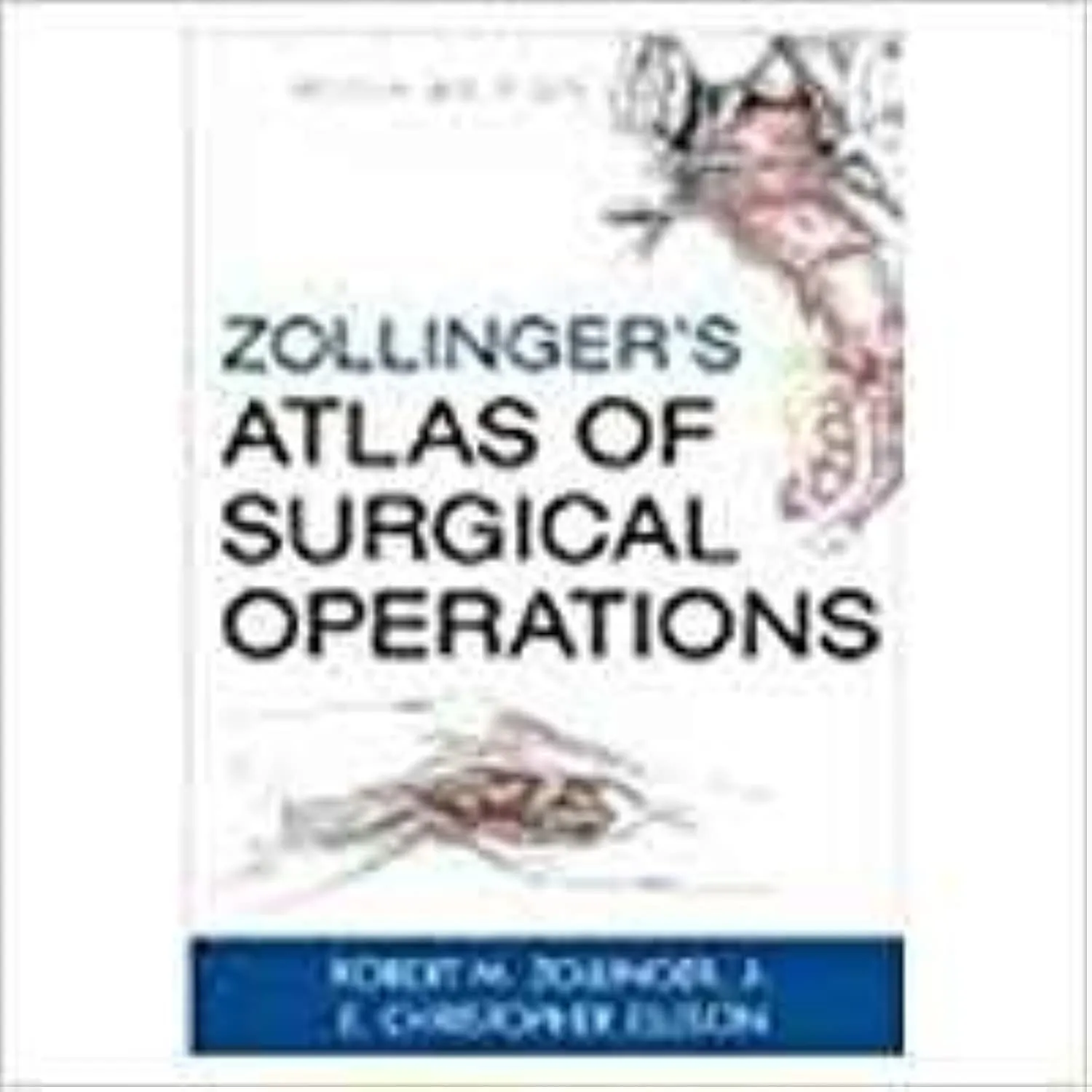 (Old)Zollinger'S Atlas Of Surgical Operations(Ie) | Hardcover