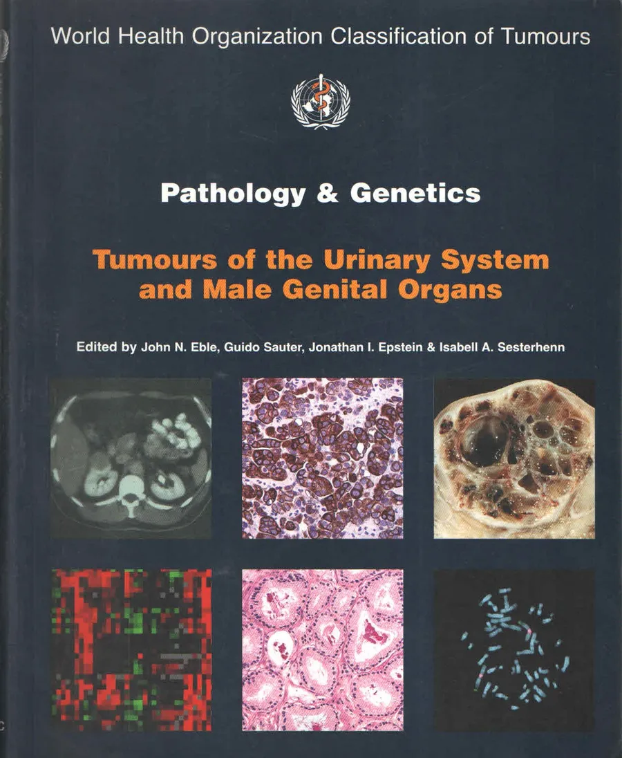 Pathology And Genetics Tumours Of The Urinary System And Male Genital Organs Who Classification Of Tum | Paperback