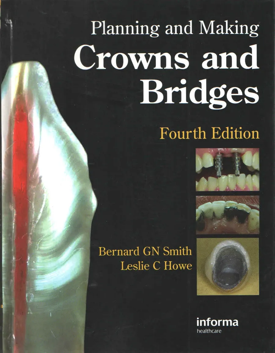 (Ex)Planning And Making Crowns And Bridges | Hardcover
