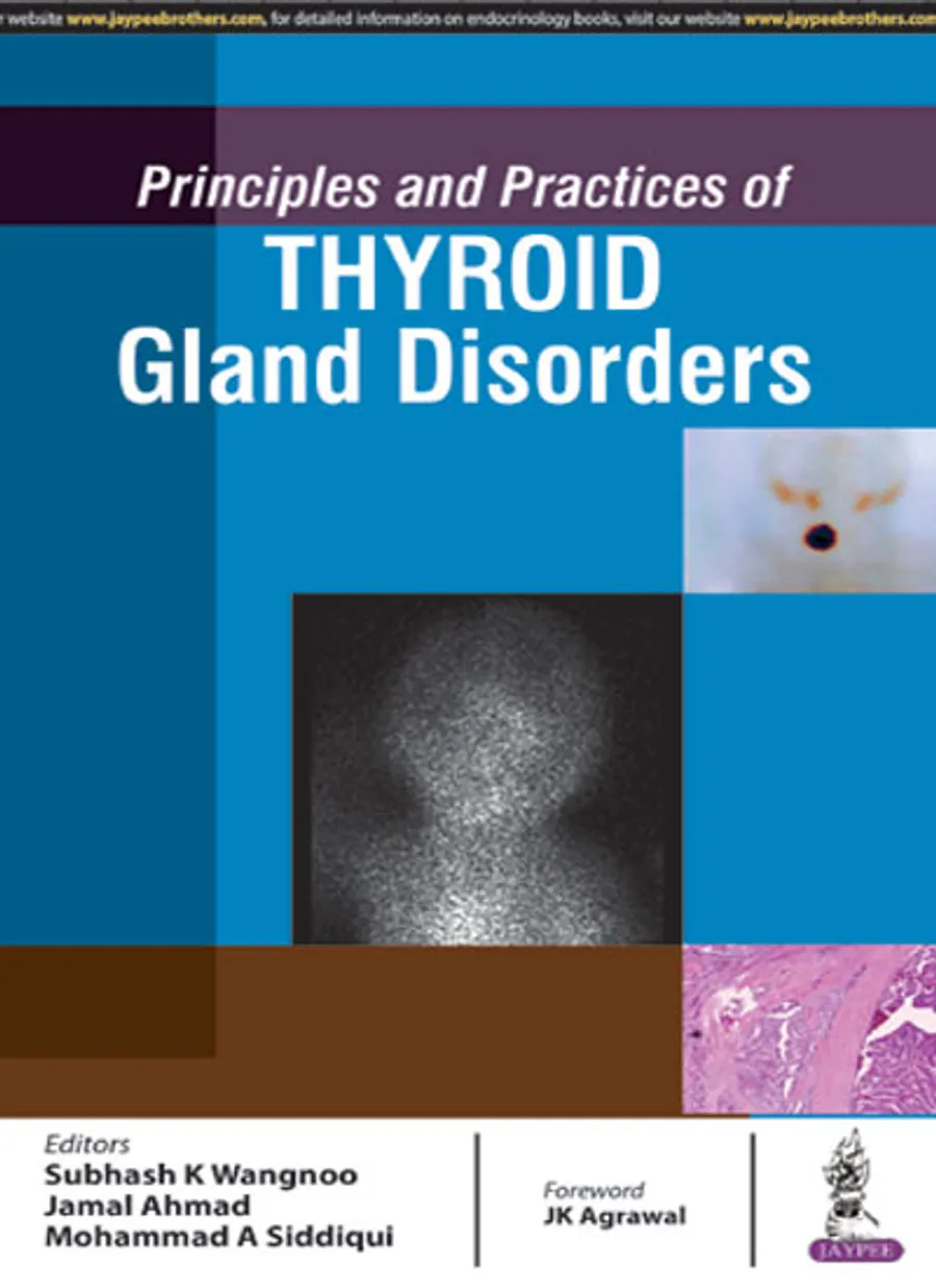 Principles And Practices Of Thyroid Gland Disorders | Paperback