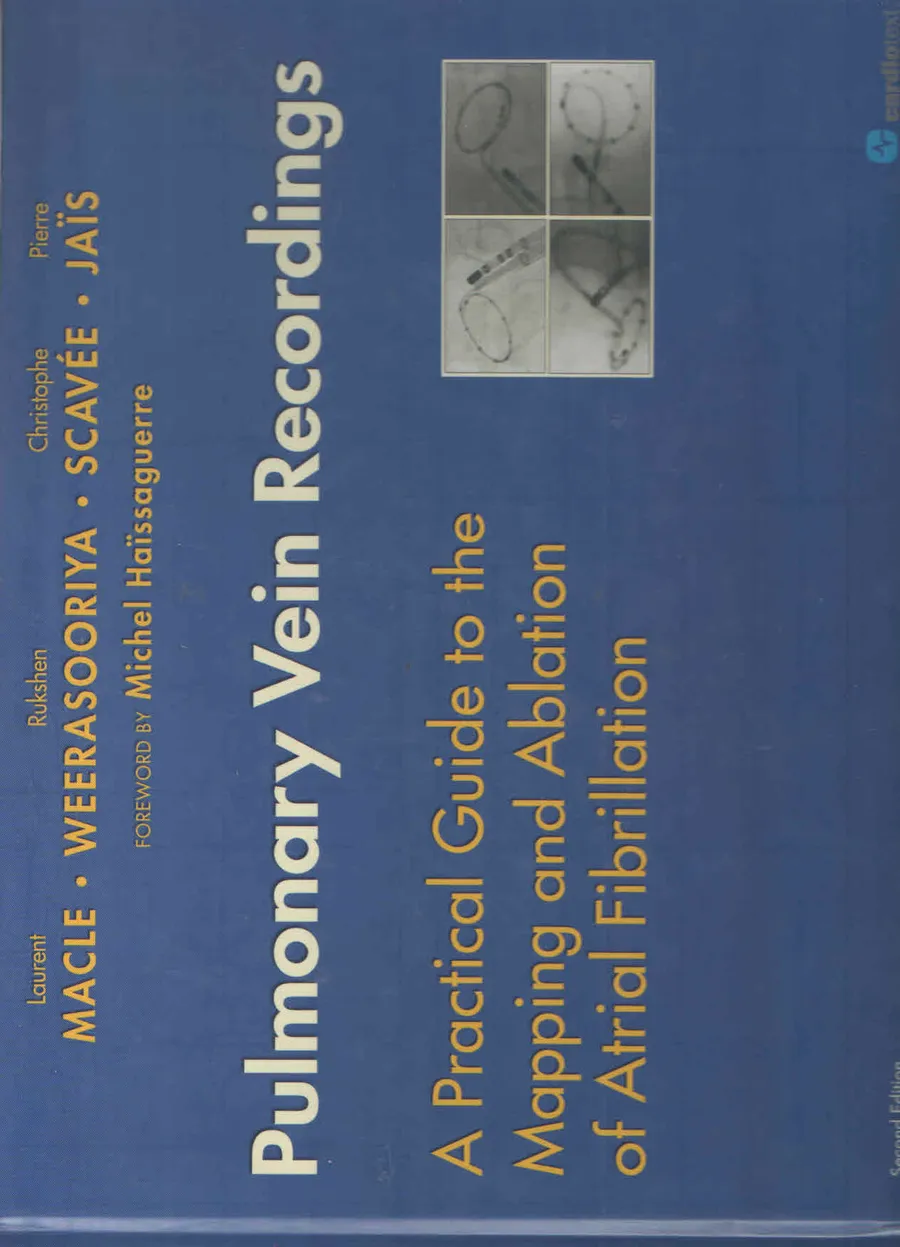 (Ex)Pulmonary Vein Recordings:A Practical Guide To The Mapping And Ablation Of Atrial Fibrillation | Hardcover