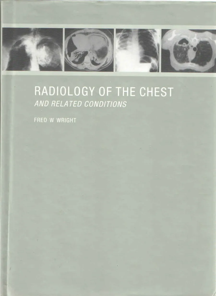 Radiology Of The Chest And Related Conditions With Cd-Rom