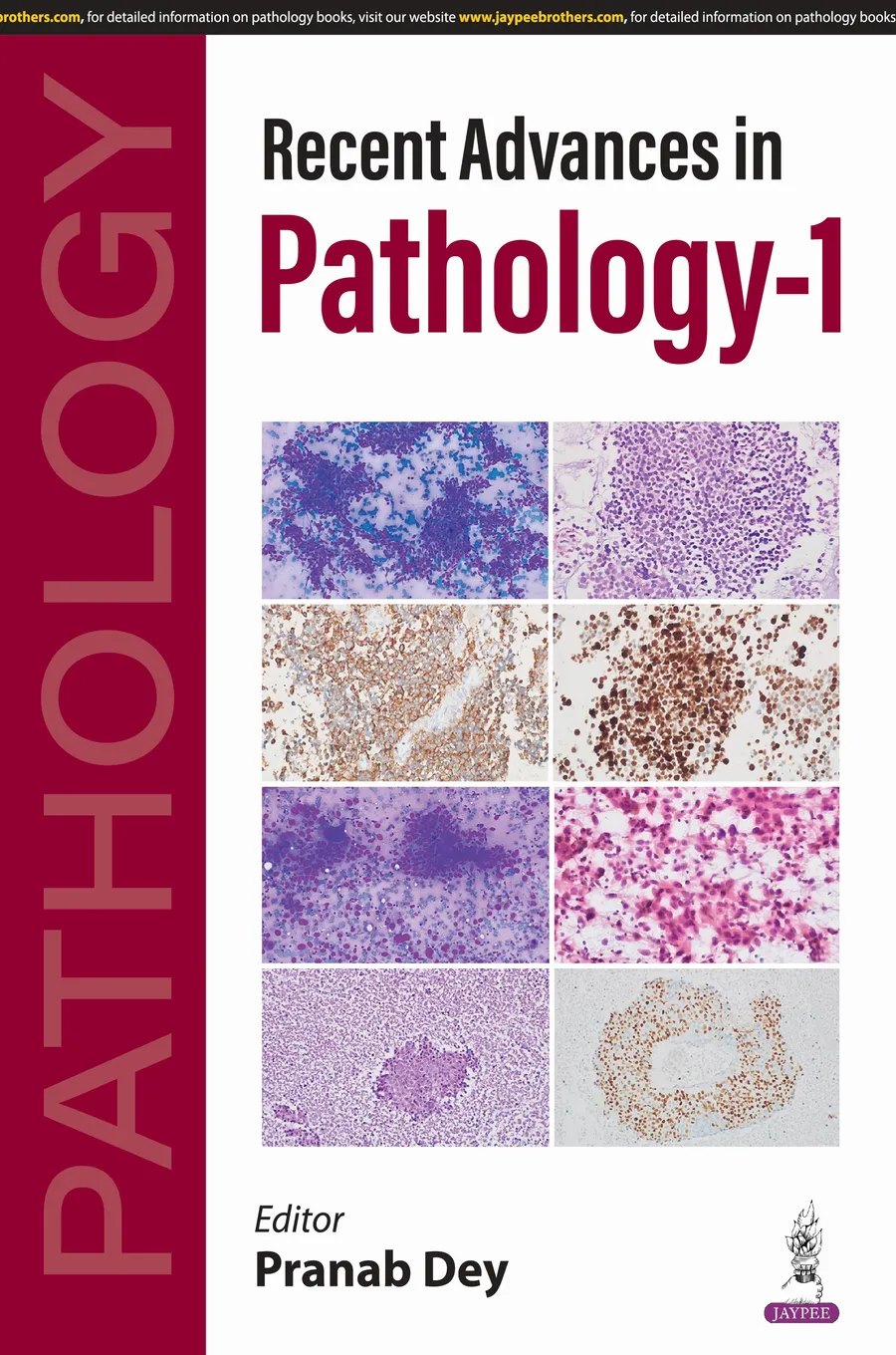 Recent Advances In Pathology-1 | Paperback
