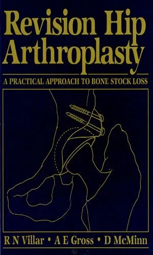(Old)Revision Hip Arthroplasty A Practical Approach To Bone Stock Loss