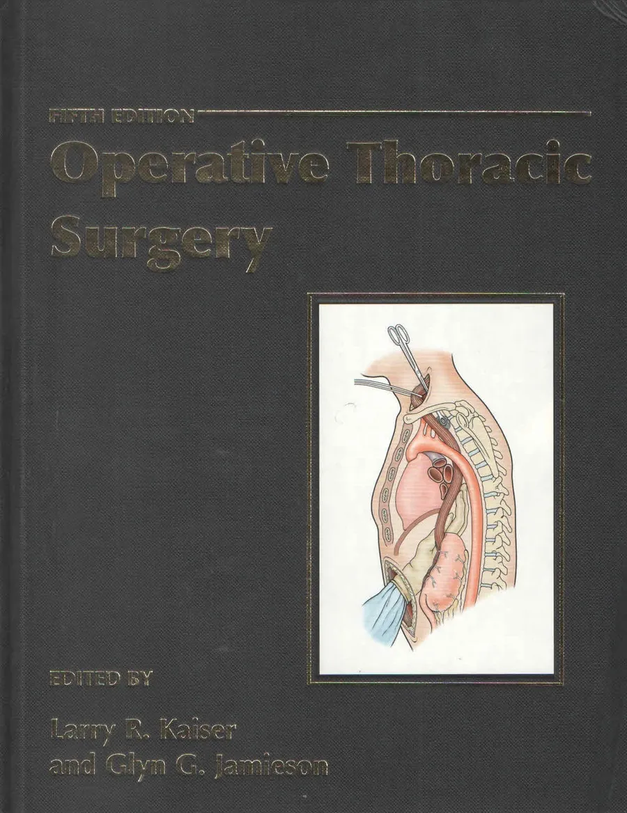 (Ex)(Old)Rob And Smith'S Operative Thoracic Surgery | Hardcover