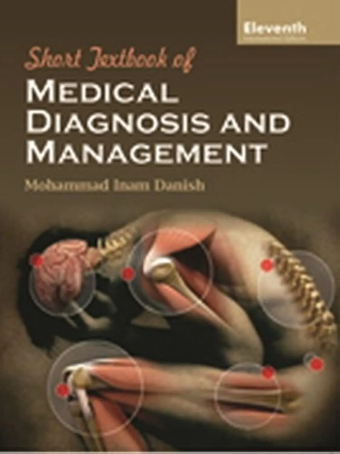 Short Textbook Of Medical Diagnosis And Management 11st Edition | Paperback