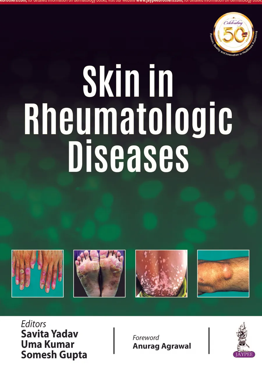 Skin In Rheumatologic Diseases | Paperback