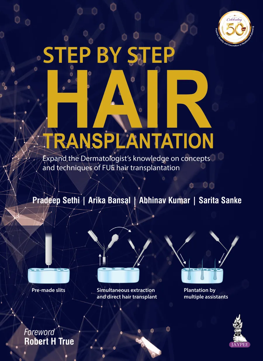 Step By Step Hair Transplantation | Hardcover
