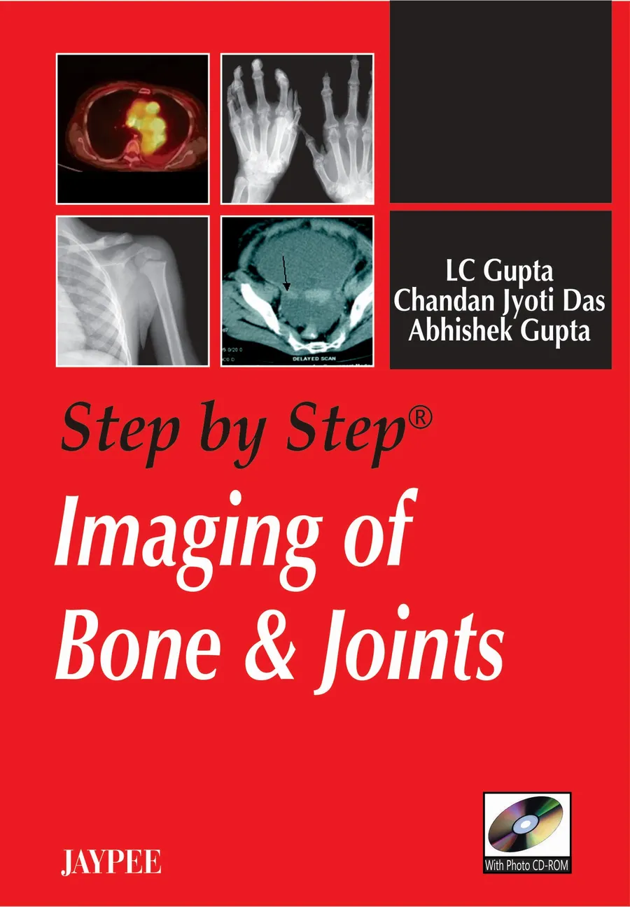 Step By Step Imaging Of Bone & Joints With Photo Cd-Rom | Paperback