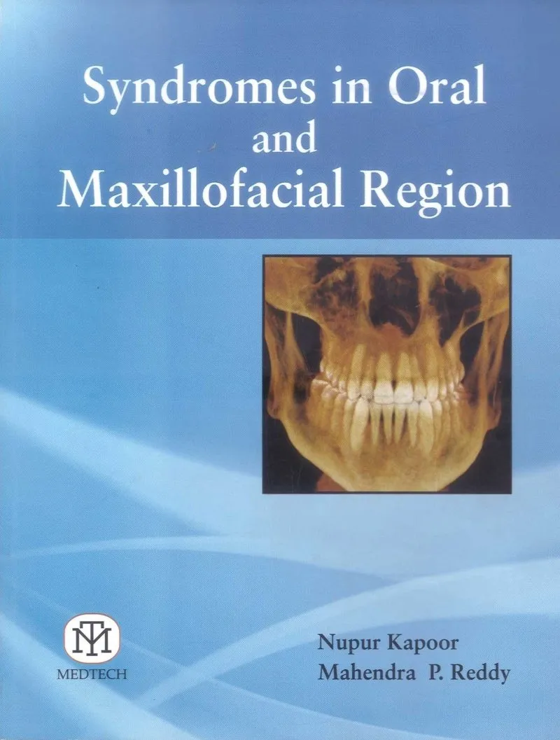 Syndromes In Oral And Maxillofacial Region | Paperback