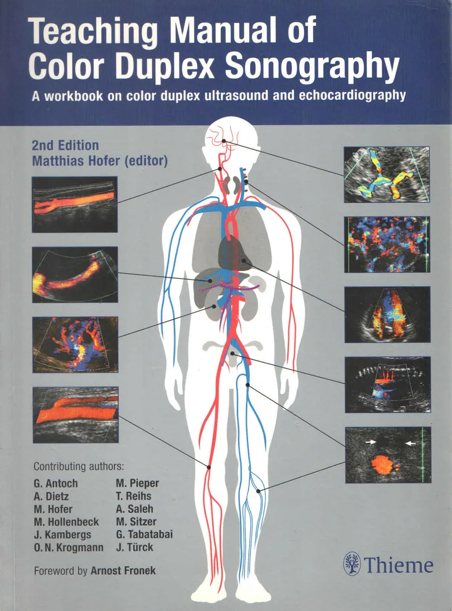(Ex)(Old)Teaching Manual Of Color Duplex Sonography