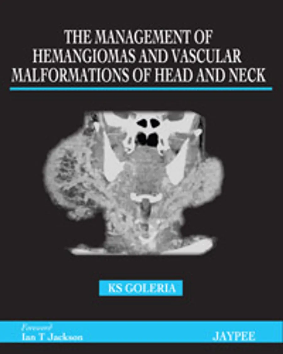 The Management Of Hemangiomas And Vascular Malformations Of Head And Neck | Hardcover