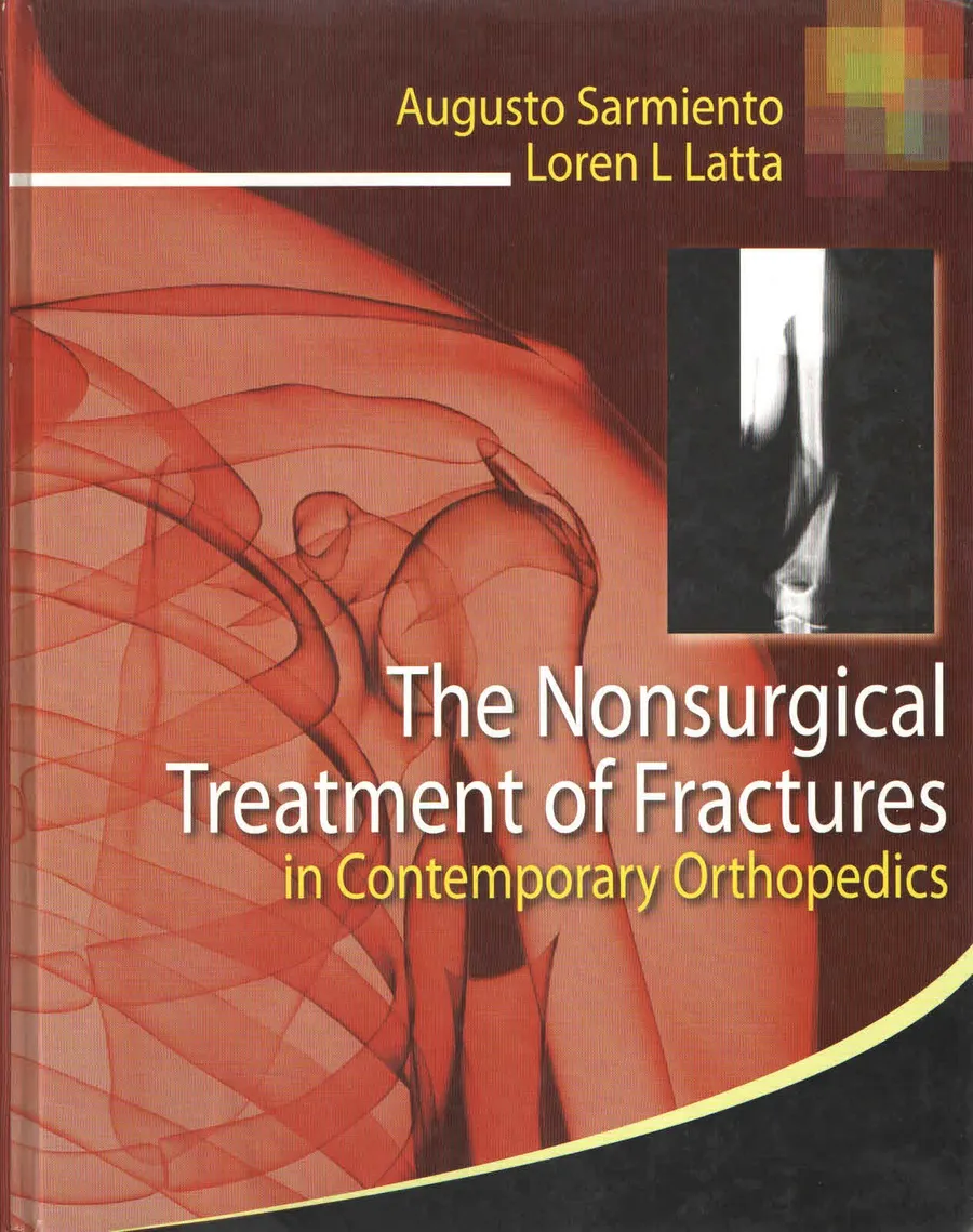 (Ex)The Nonsurgical Treatment Of Fractures (In Contemporary Orthopedics) | Hardcover