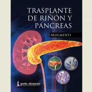 Trasplante De Rinony Pancreas | Hardcover