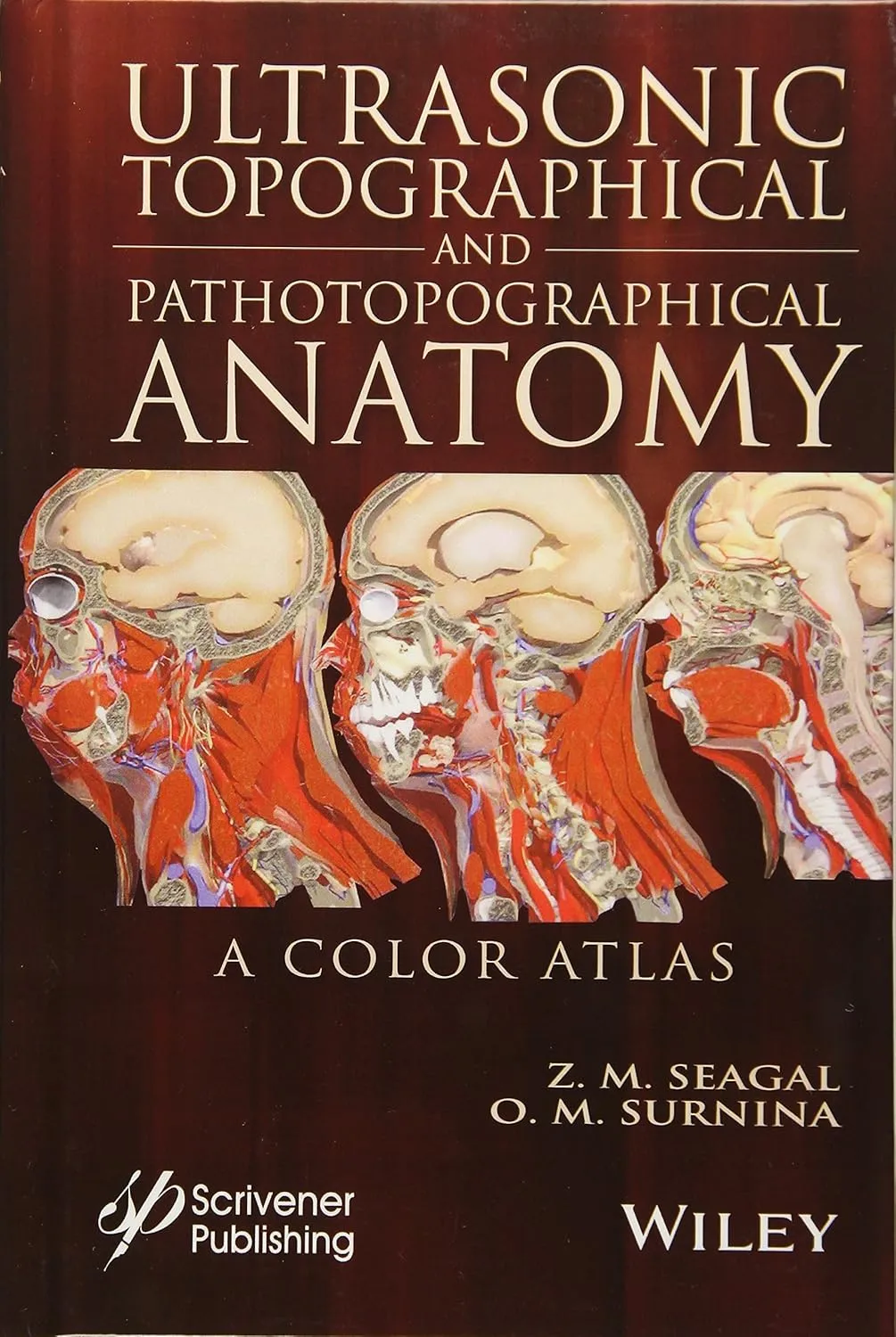 Ultrasonic Topographical and Pathotopographical Anatomy | Hardcover