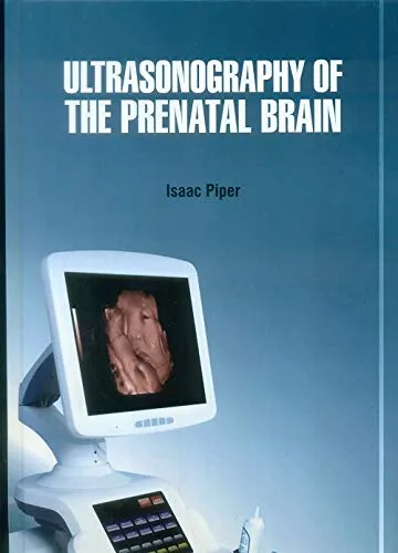 Ultrasonography of The Prenatal Brain | Hardcover