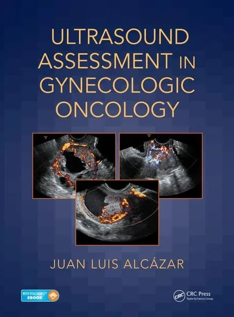 Ultrasound Assessment in Gynecologic Oncology | Hardcover