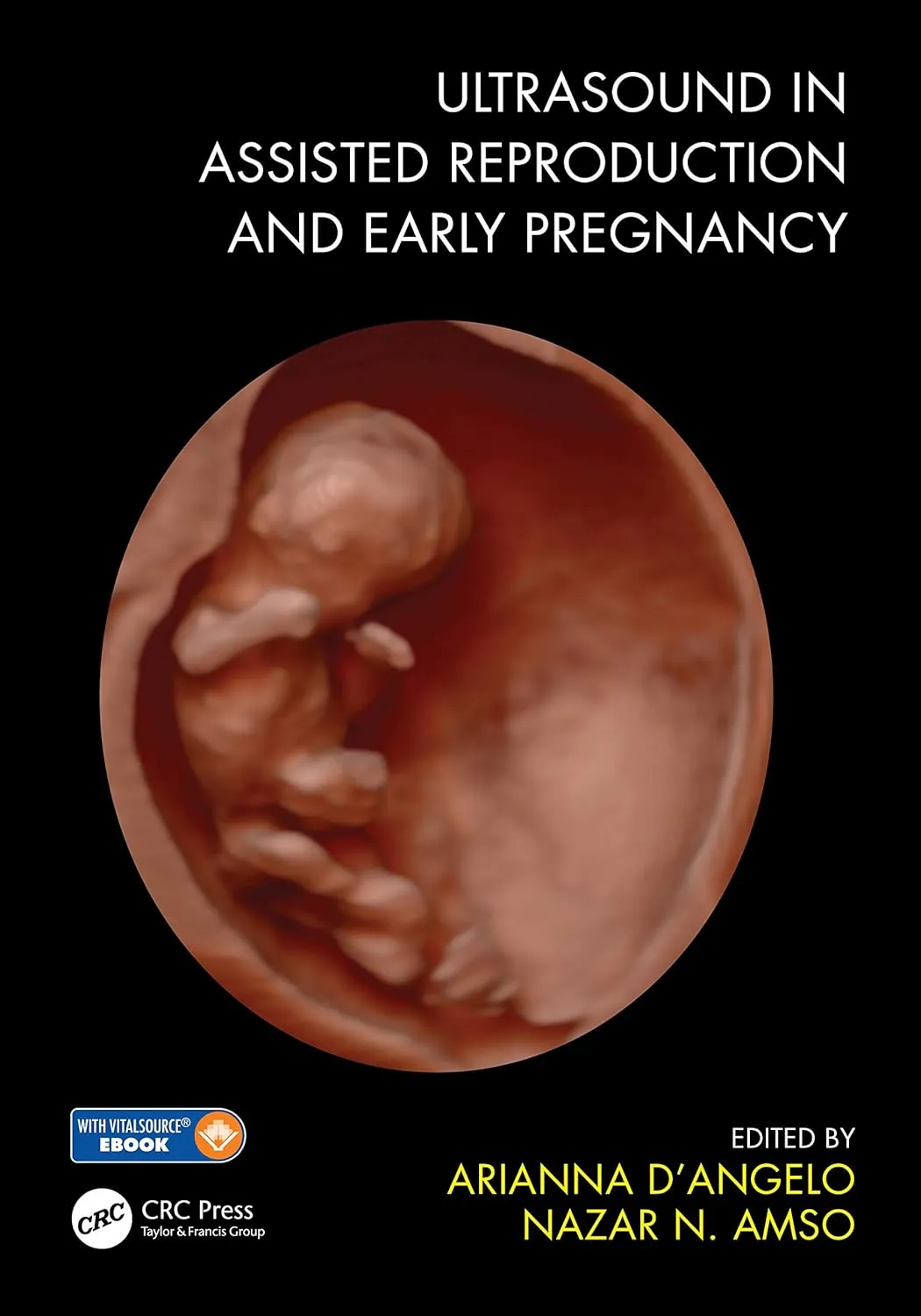 Ultrasound In Assisted Reproduction And Early Pregnancy With Access Code | Paperback