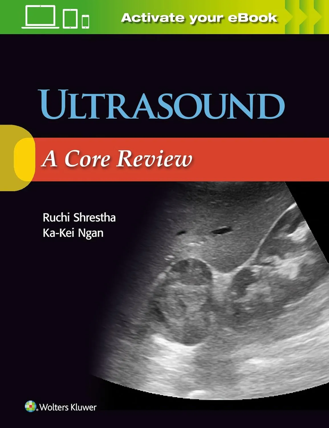 Ultrasound A Core Review | Paperback
