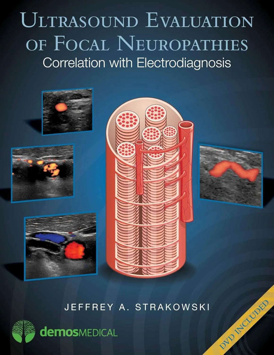 Ultrasound Evaluation of Focal Neuropathies Correlation with Electrodiagnosis | With DVD | Hardcover