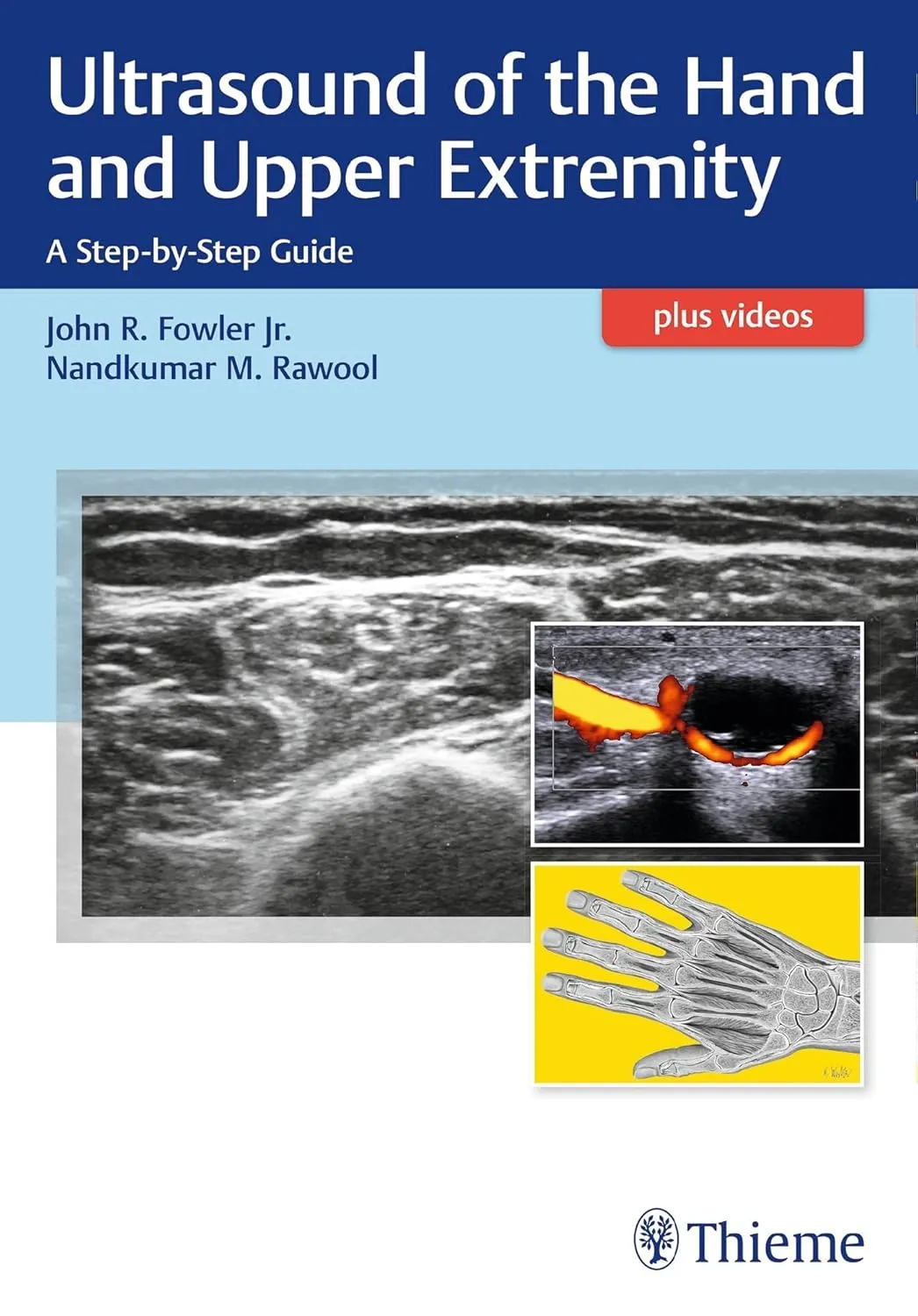 Ultrasound of the Hand and Upper Extremity | Paperback