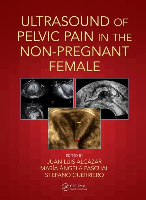Ultrasound of Pelvic Pain in the Non-Pregnant Female | Paperback