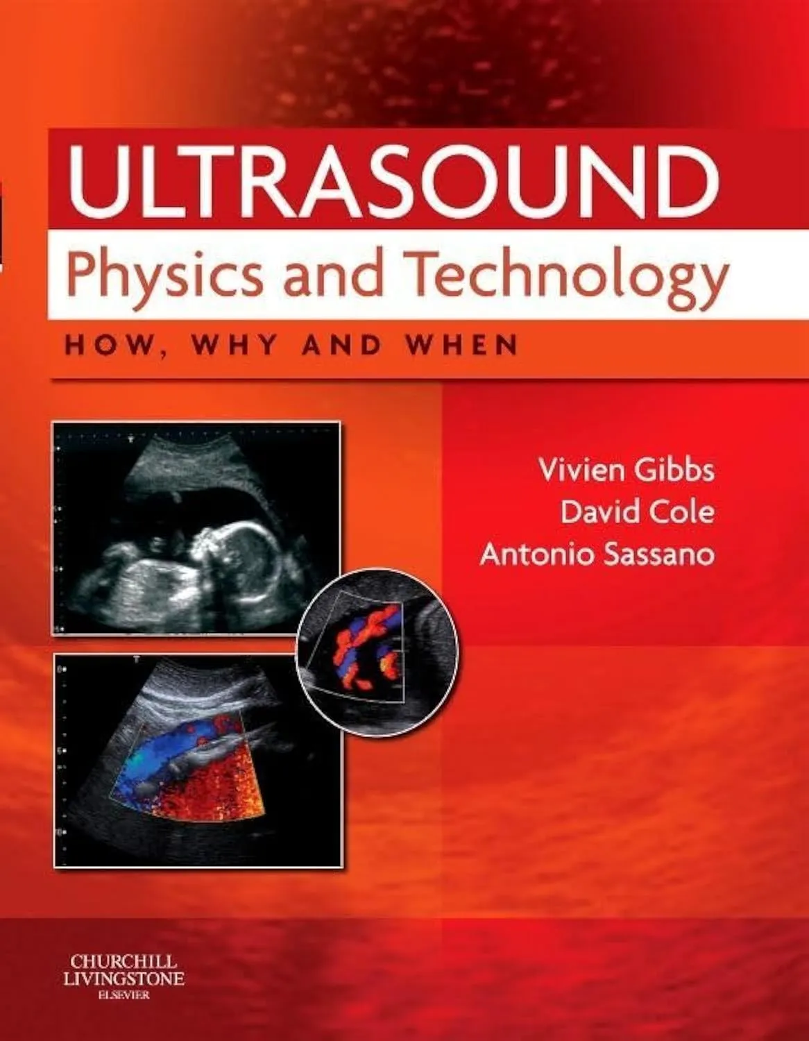 Ultrasound Physics and Technology How | Why and When | Hardcover