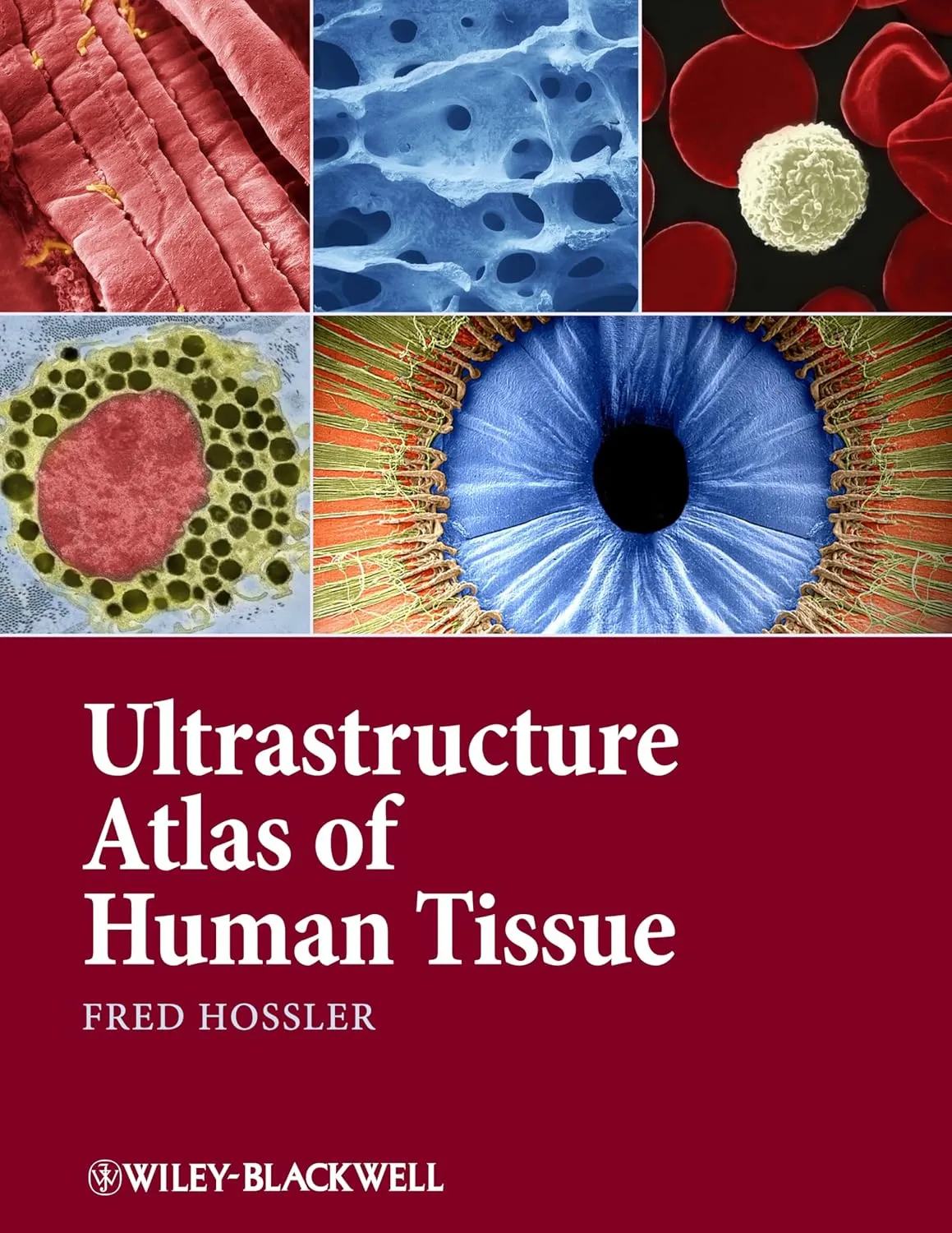 Ultrastructure Atlas of Human Tissues | Hardcover
