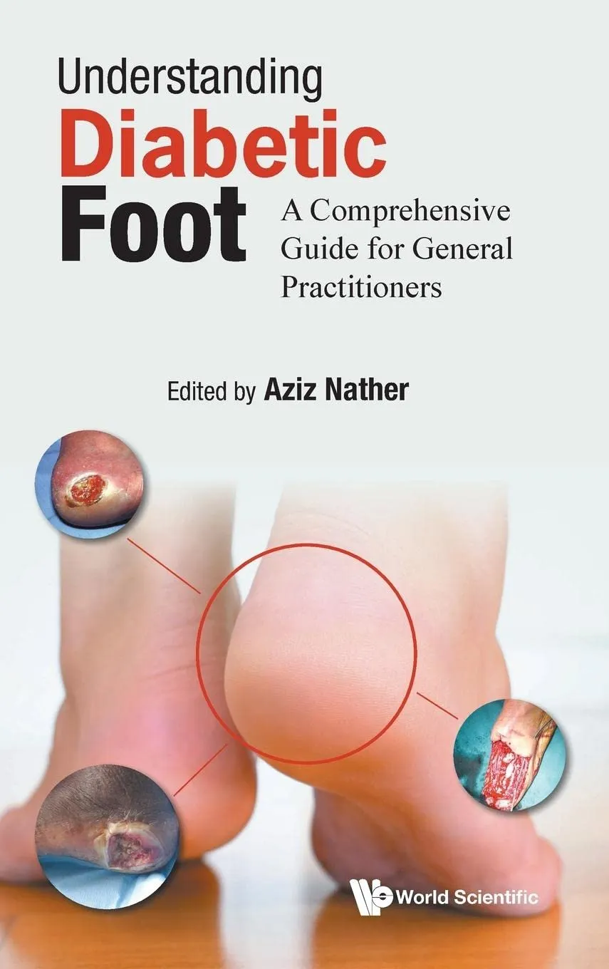 Understanding Diabetic Foot A Comprehensive Guide For General Practitioners | Hardcover