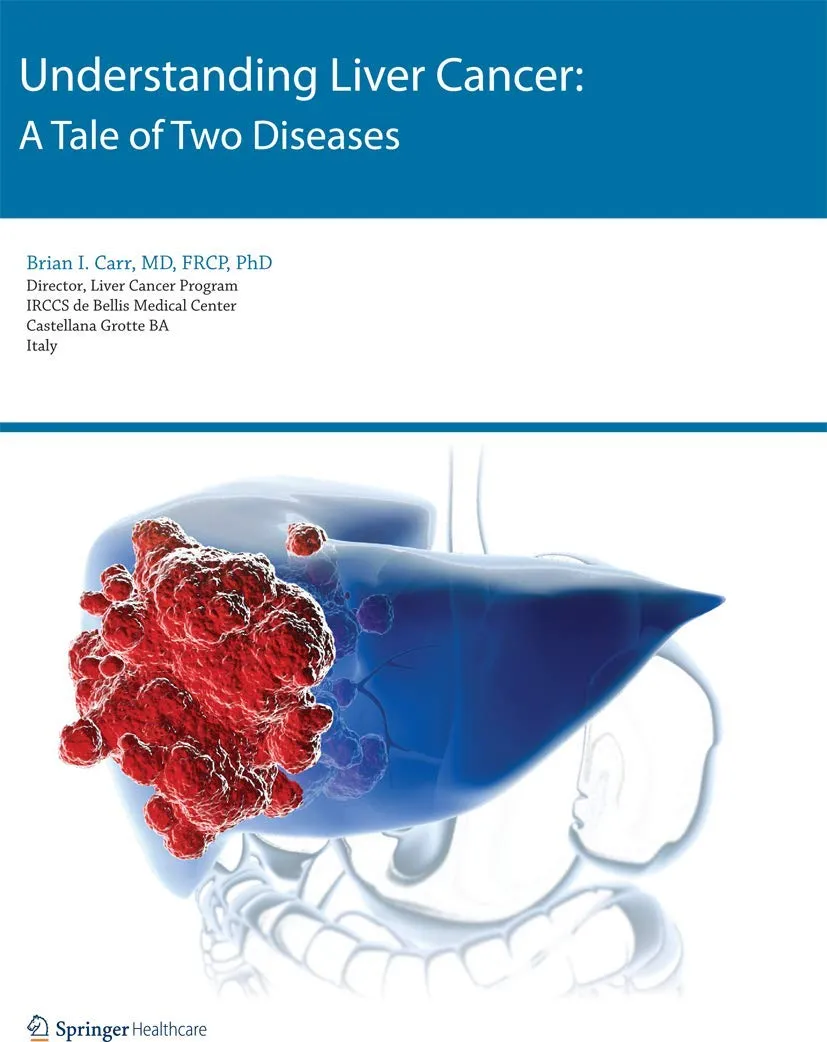 Understanding Liver Cancer A Tale of Two Diseases | Paperback