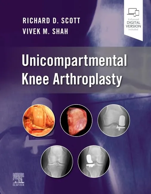 Unicompartmental Knee Arthroplasty With Access Code | Hardcover