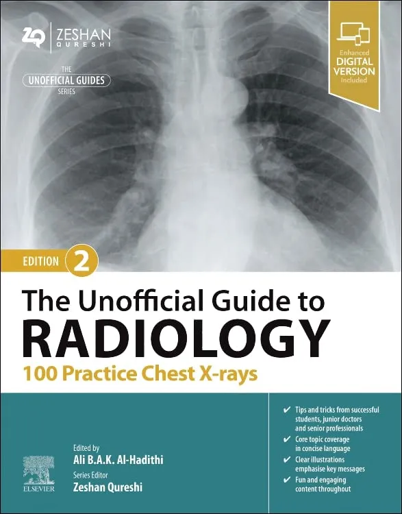 The Unofficial Guide To Radiology 100 Practice Chest X Rays With Access Code 2nd Edition | Paperback