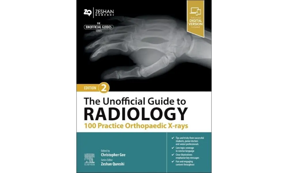 The Unofficial Guide To Radiology 100 Practice Orthopaedic X Rays With Access Code 2nd Edition | Paperback