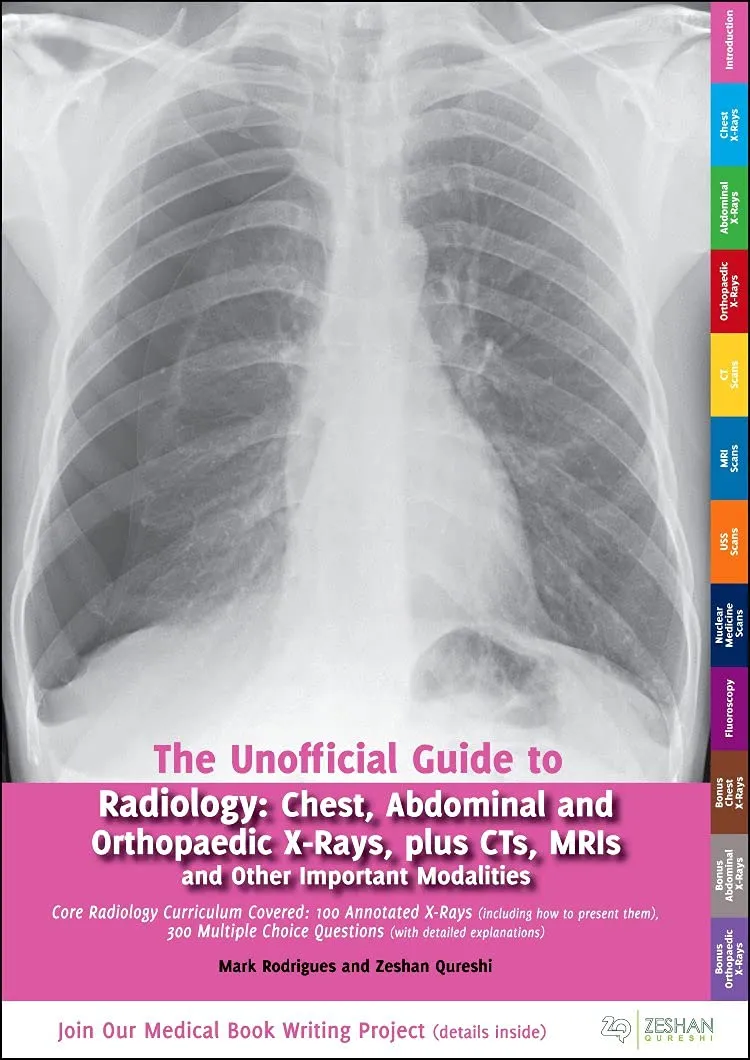 The Unofficial Guide to Radiology Chest | Abdominal and Orthopaedic X-Rays | Plus CTs | MRIs and Other Important Modalities | Paperback