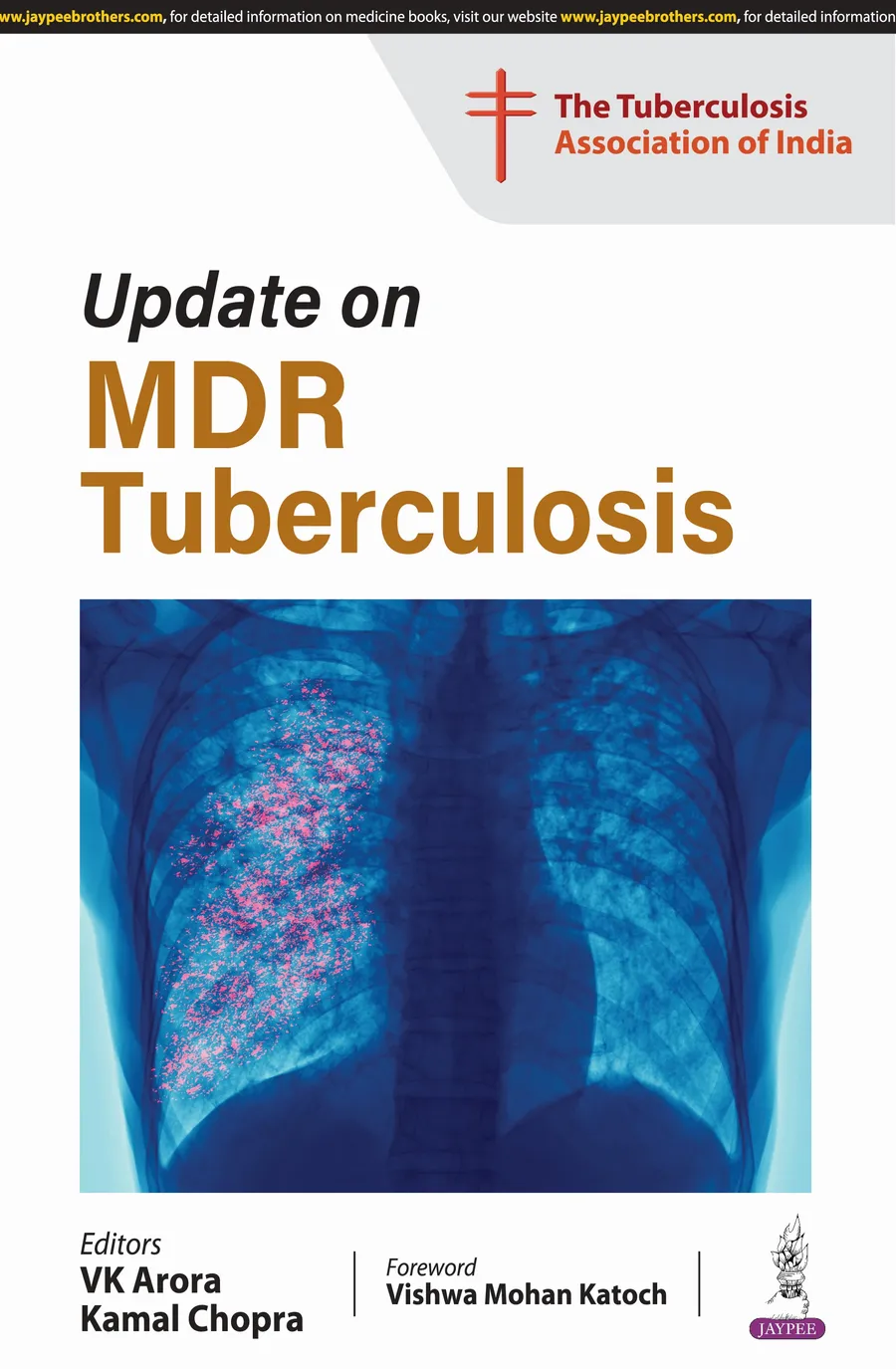 Update On Mdr Tuberculosis | Paperback