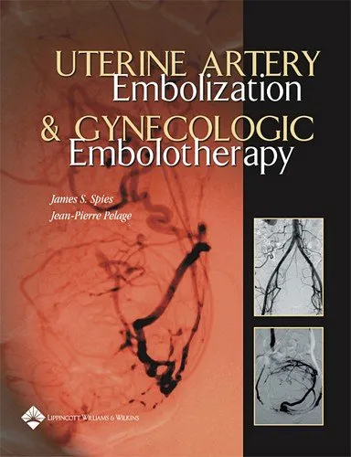 Uterine Artery Embolization and Gynecologic Embolotherapy | Hardcover