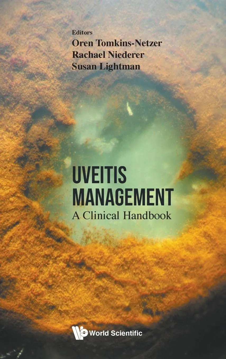 Uveitis Management A Clinical Handbook | Hardcover