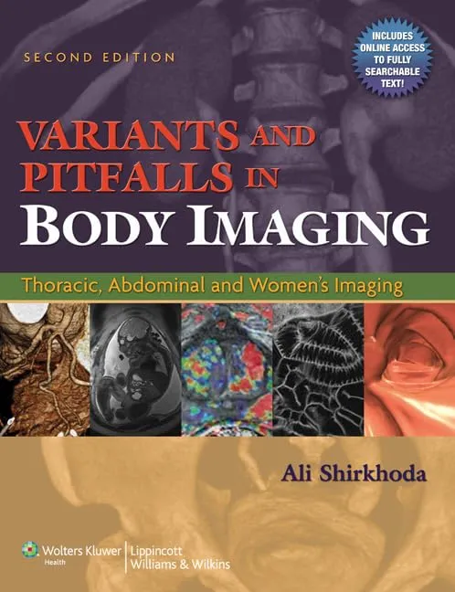Variants and Pitfalls in Body Imaging Thoracic | Abdominal and Women's Imaging | 2nd Edition | Hardcover