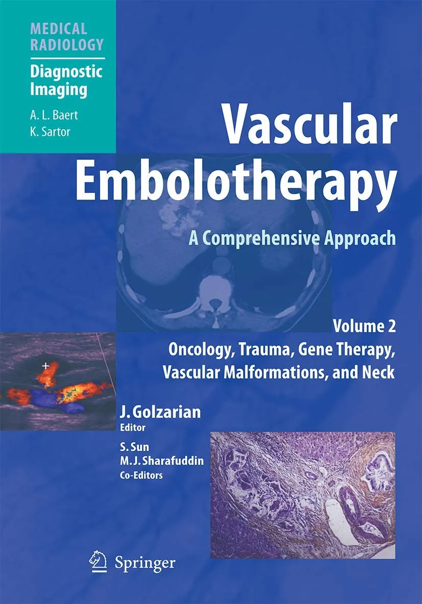 Vascular Embolotherapy A Comprehensive Approach | Volume 2 | Hardcover