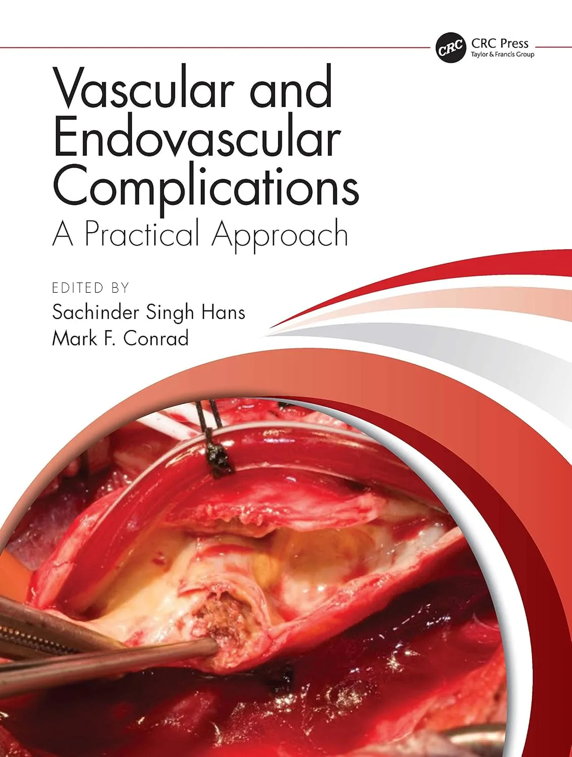 Vascular And Endovascular Complications A Practical Approach | Hardcover